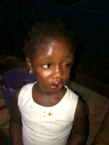 A W!cked Woman Starves And Beats A 5-year-old To Tatters(Photos)