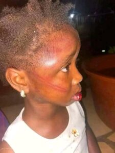 A W!cked Woman Starves And Beats A 5-year-old To Tatters(Photos)